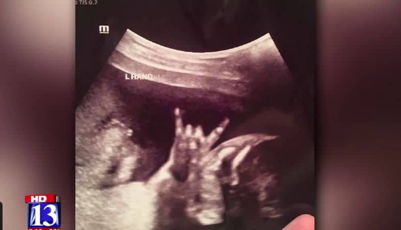 Sonogram Shows Baby Flashing the Rock and Roll Sign