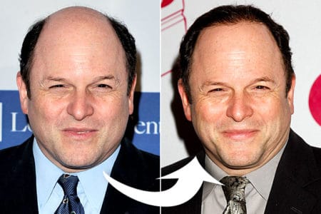 Five Actors Who Have More Hair Now than When They Were Younger