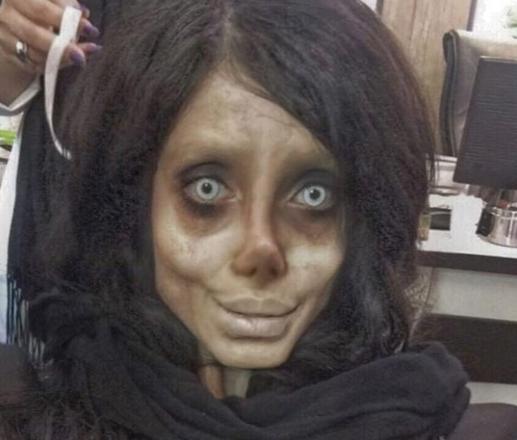 Teen Dubbed &#8220;Corpse Bride&#8221; Had 50 Surgeries Just To Look Like Angelina Jolie