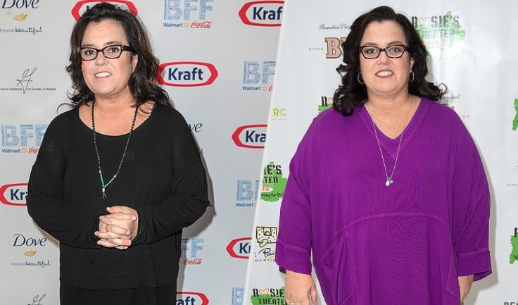 20 Celebrities Who Have Had Weight Loss Surgery