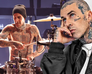 Travis Barker’s Recovery Journey After Severe Burns