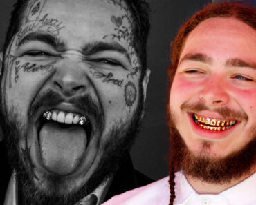 Post Malone’s $1.6 Million Diamond Teeth Transformation