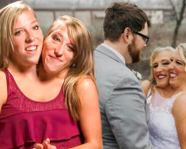 Did Conjoined Twins Abby And Brittany Hensel Get Married?