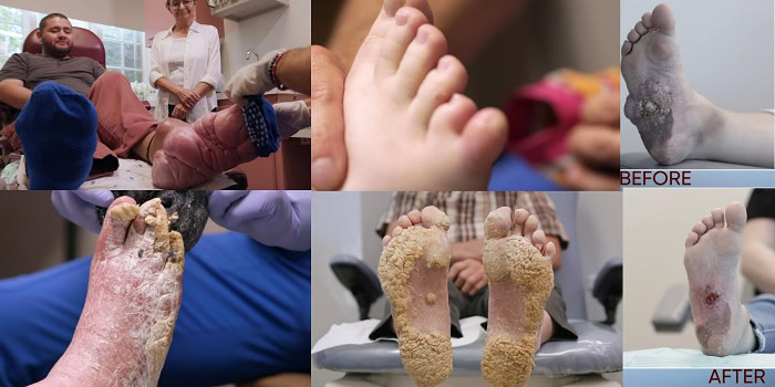 A photo collage of patients on My Feet Are Killing Me