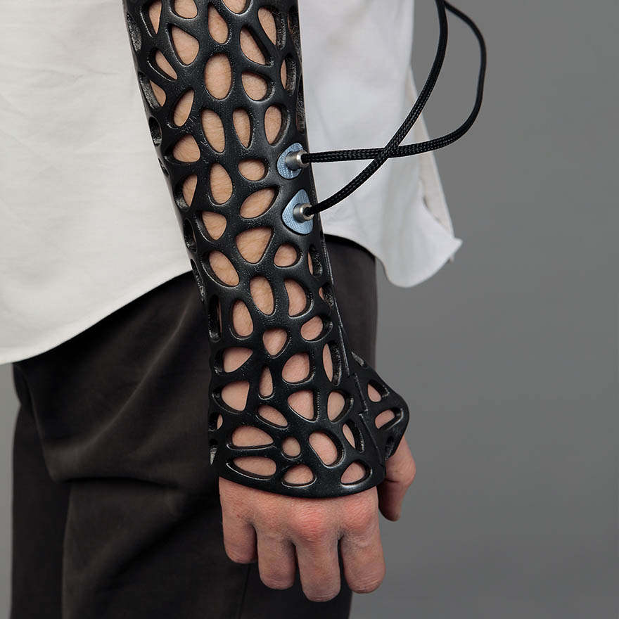 3D-Printed Plastic Cast Looks Awesome And Uses Ultrasound To Heal Broken Bones Faster