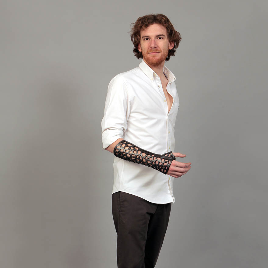 3D-Printed Plastic Cast Looks Awesome And Uses Ultrasound To Heal Broken Bones Faster