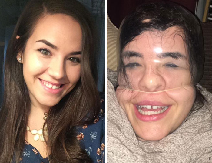 292 Before &amp; After Pics That You Won’t Believe Show The Same Girls