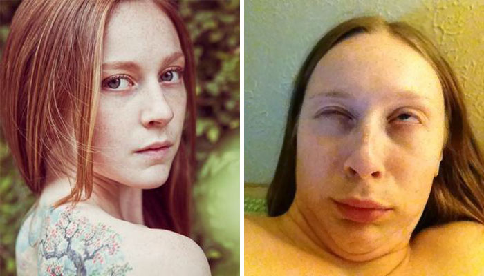 292 Before &amp; After Pics That You Won’t Believe Show The Same Girls