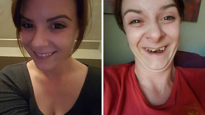 292 Before &amp; After Pics That You Won’t Believe Show The Same Girls