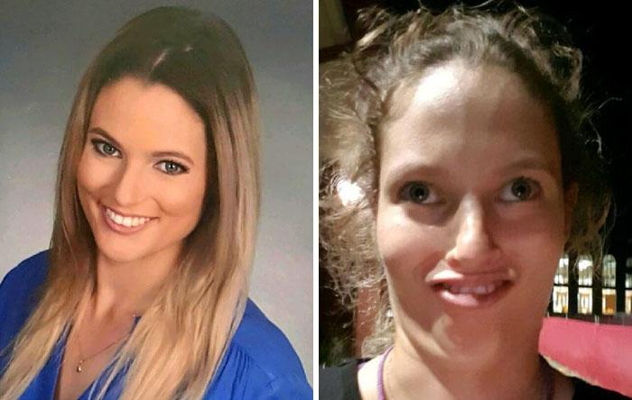 292 Before &amp; After Pics That You Won’t Believe Show The Same Girls