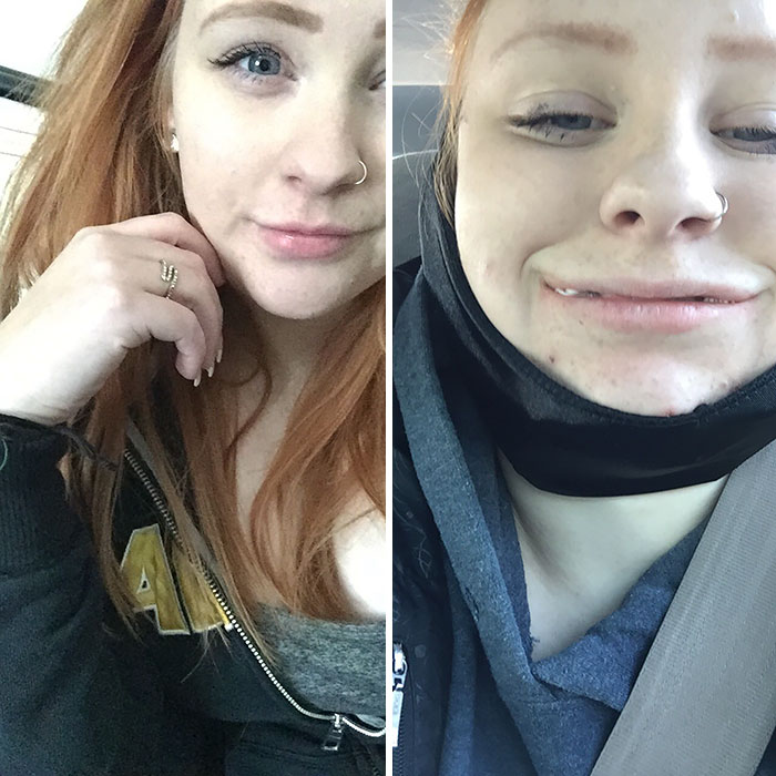 292 Before &amp; After Pics That You Won’t Believe Show The Same Girls