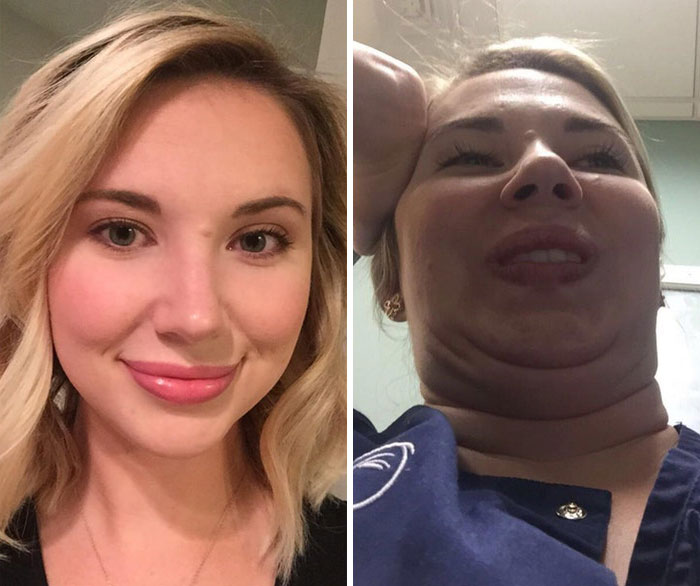 292 Before &amp; After Pics That You Won’t Believe Show The Same Girls