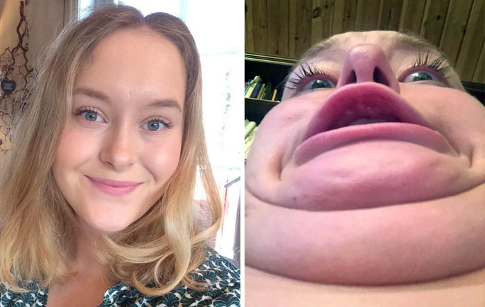 292 Before &amp; After Pics That You Won’t Believe Show The Same Girls