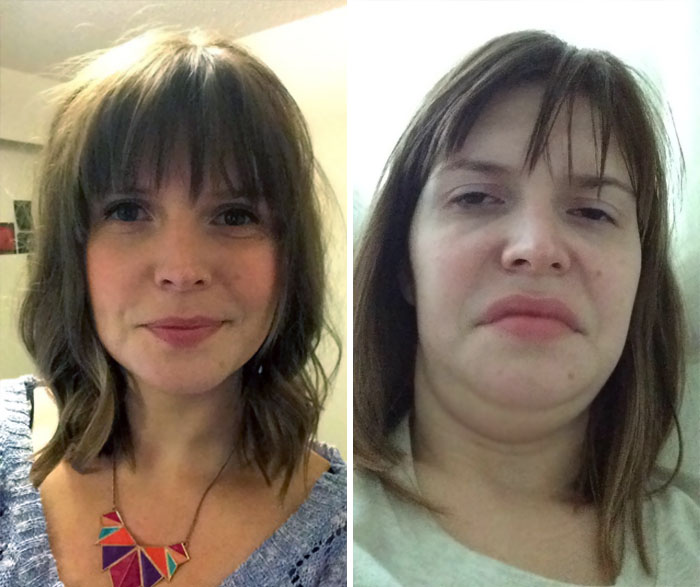 292 Before &amp; After Pics That You Won’t Believe Show The Same Girls