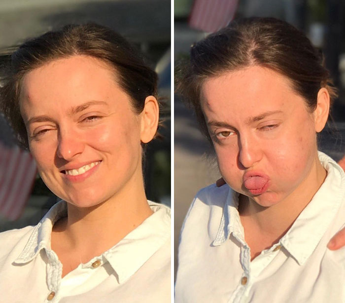 292 Before &amp; After Pics That You Won’t Believe Show The Same Girls
