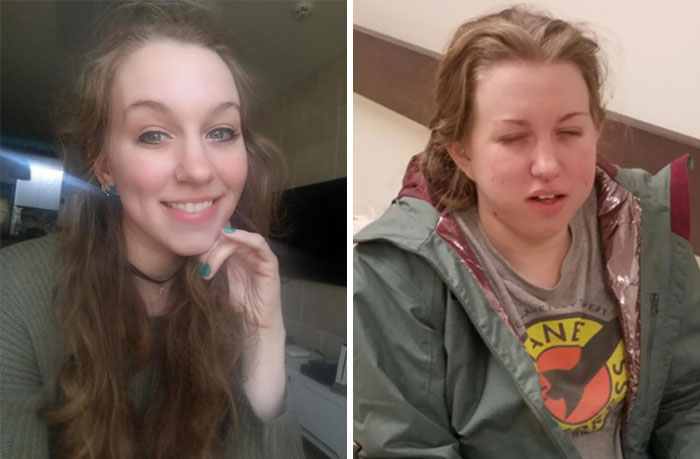 292 Before &amp; After Pics That You Won’t Believe Show The Same Girls