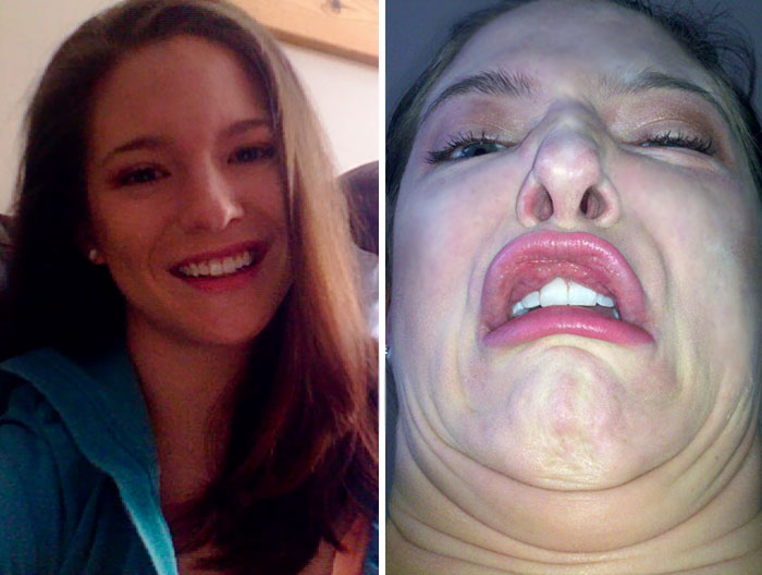 292 Before &amp; After Pics That You Won’t Believe Show The Same Girls
