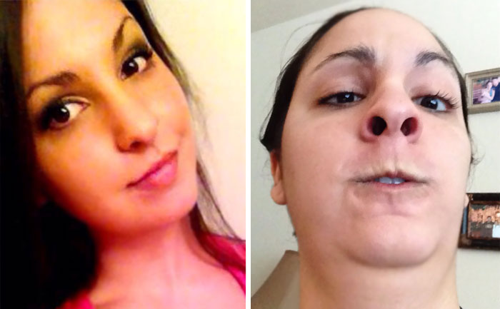 292 Before &amp; After Pics That You Won’t Believe Show The Same Girls