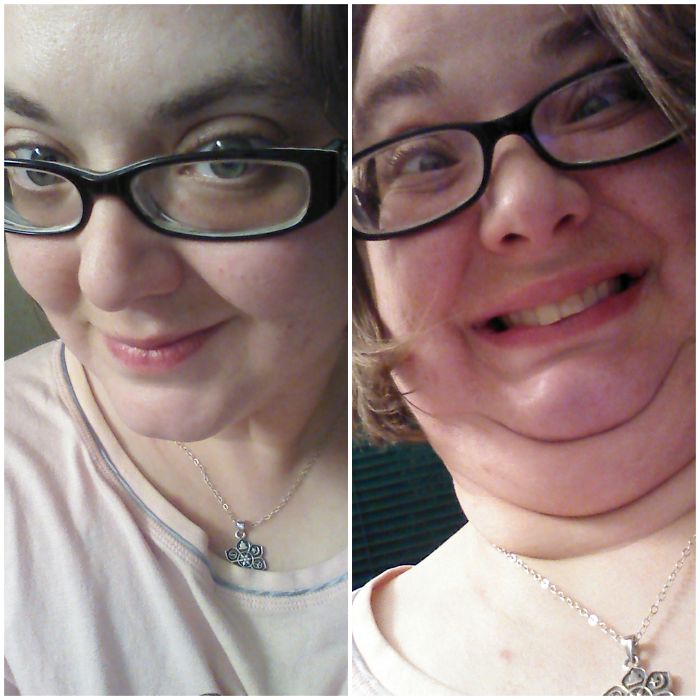 292 Before &amp; After Pics That You Won’t Believe Show The Same Girls