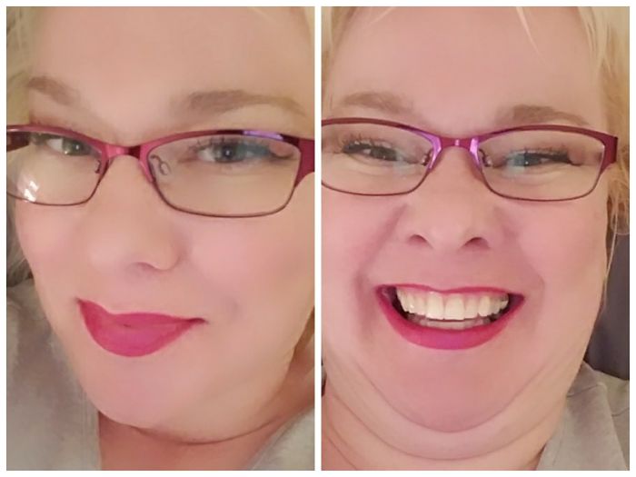 292 Before &amp; After Pics That You Won’t Believe Show The Same Girls