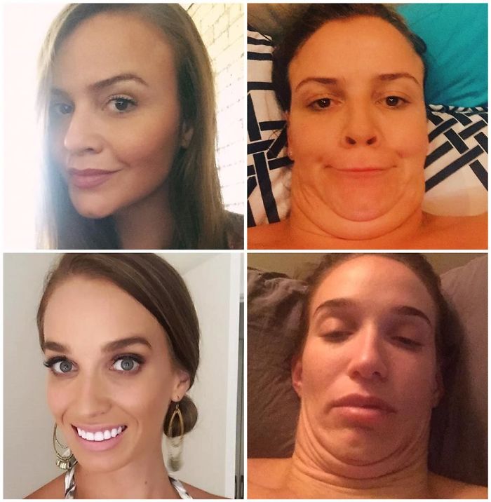 292 Before &amp; After Pics That You Won’t Believe Show The Same Girls