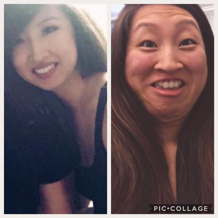 292 Before &amp; After Pics That You Won’t Believe Show The Same Girls