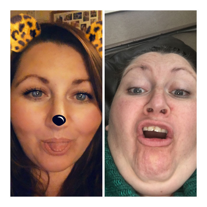 292 Before &amp; After Pics That You Won’t Believe Show The Same Girls