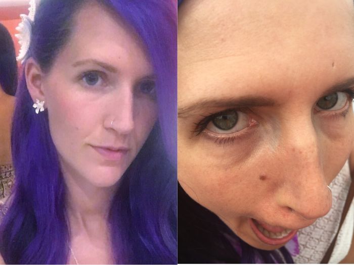 292 Before &amp; After Pics That You Won’t Believe Show The Same Girls