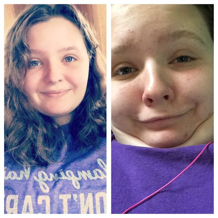 292 Before &amp; After Pics That You Won’t Believe Show The Same Girls