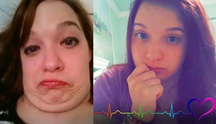 292 Before &amp; After Pics That You Won’t Believe Show The Same Girls