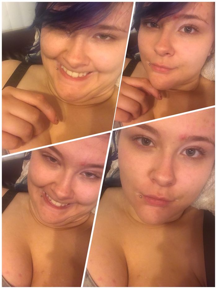 292 Before &amp; After Pics That You Won’t Believe Show The Same Girls