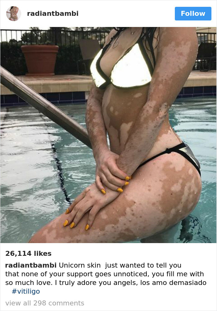 These 40 Women Ignored The Internet Shaming And Proved That Every Body Is Bikini Body