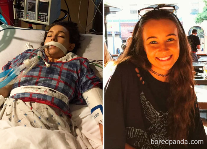 59 Before & After Pics That Show What Happens When You Stop Drinking 59 Before & After Pics That Show What Happens When You Stop Drinking