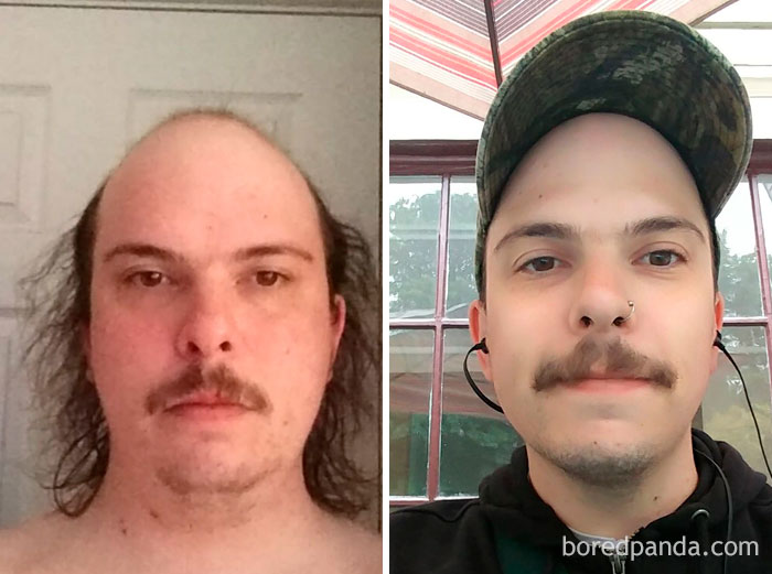 59 Before & After Pics That Show What Happens When You Stop Drinking 59 Before & After Pics That Show What Happens When You Stop Drinking