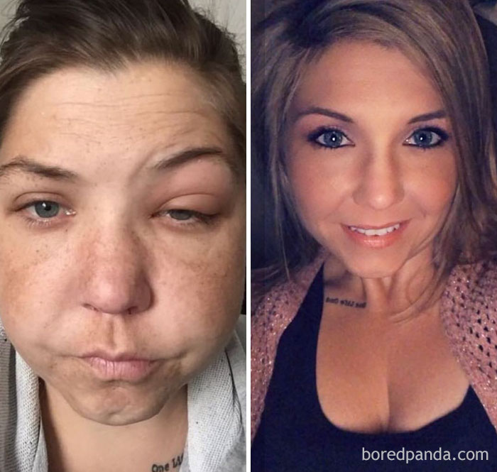 59 Before & After Pics That Show What Happens When You Stop Drinking 59 Before & After Pics That Show What Happens When You Stop Drinking