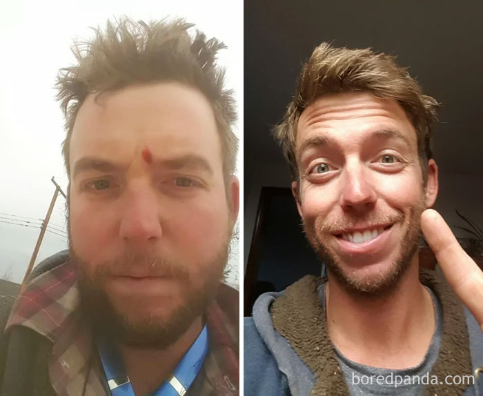 59 Before & After Pics That Show What Happens When You Stop Drinking 59 Before & After Pics That Show What Happens When You Stop Drinking