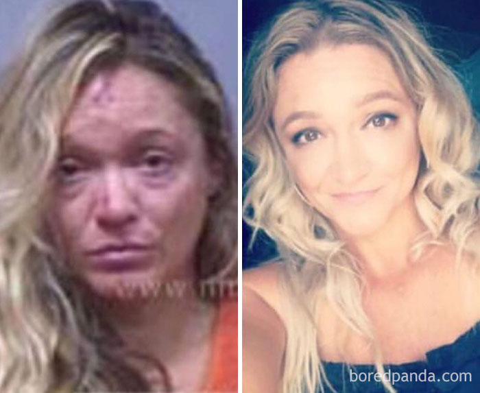 59 Before & After Pics That Show What Happens When You Stop Drinking 59 Before & After Pics That Show What Happens When You Stop Drinking