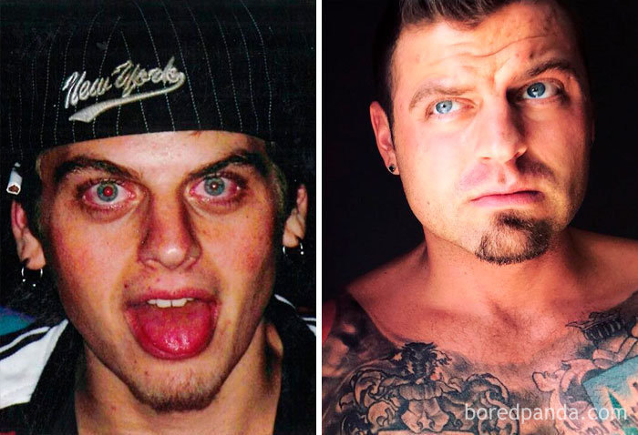 59 Before & After Pics That Show What Happens When You Stop Drinking 59 Before & After Pics That Show What Happens When You Stop Drinking