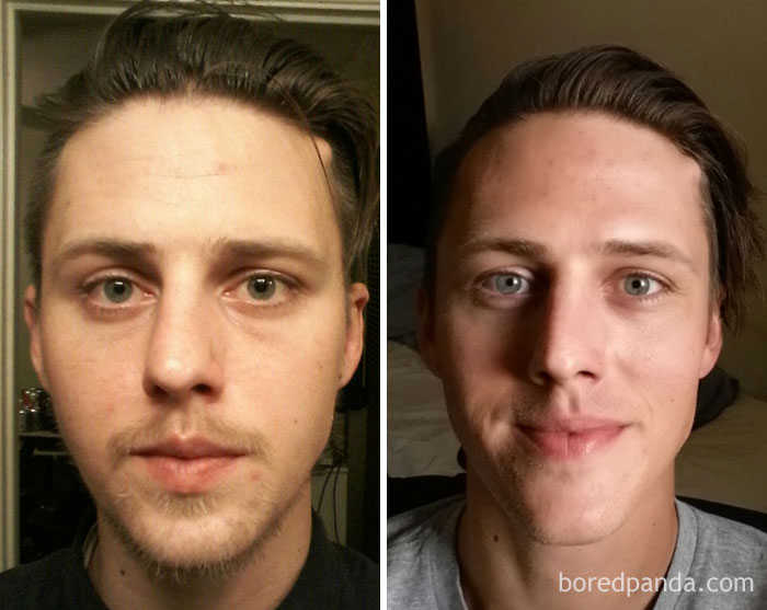 59 Before & After Pics That Show What Happens When You Stop Drinking 59 Before & After Pics That Show What Happens When You Stop Drinking