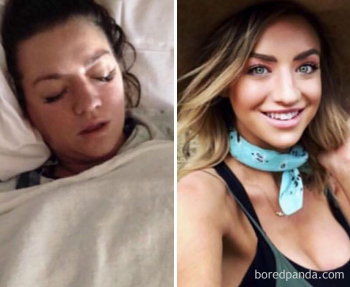 59 Before & After Pics That Show What Happens When You Stop Drinking 59 Before & After Pics That Show What Happens When You Stop Drinking