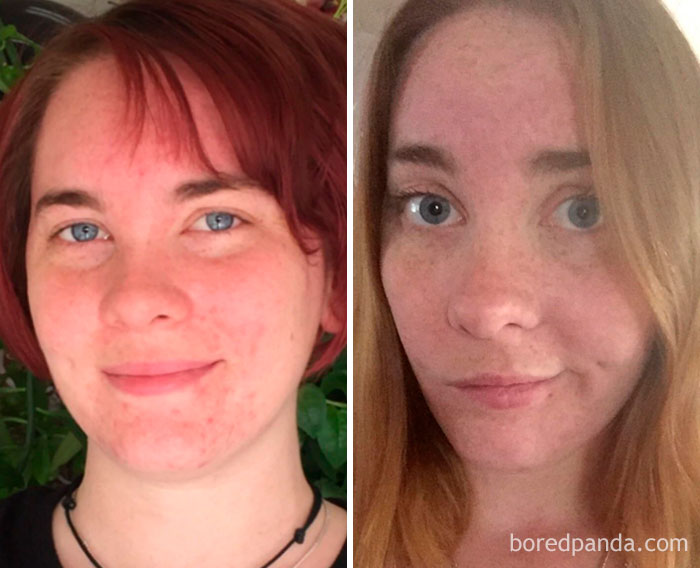 59 Before & After Pics That Show What Happens When You Stop Drinking 59 Before & After Pics That Show What Happens When You Stop Drinking