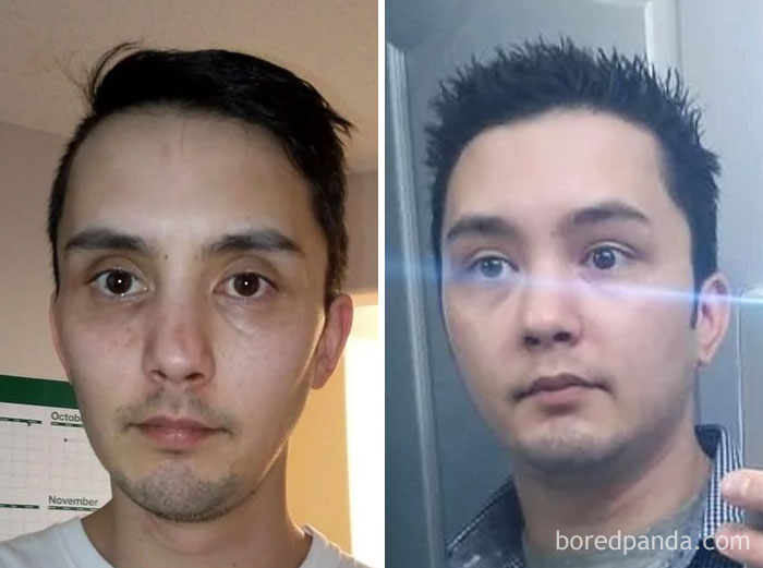 59 Before & After Pics That Show What Happens When You Stop Drinking 59 Before & After Pics That Show What Happens When You Stop Drinking