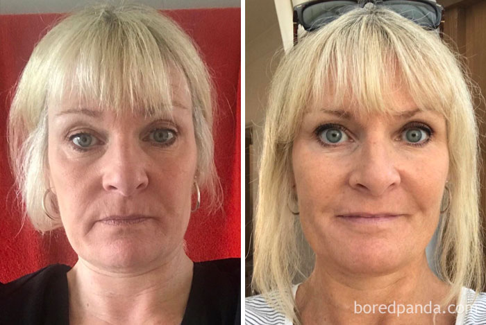 59 Before & After Pics That Show What Happens When You Stop Drinking 59 Before & After Pics That Show What Happens When You Stop Drinking