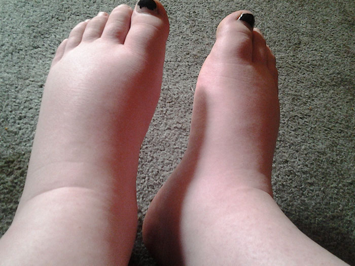 50 Pregnant Women Whose Day Is Going Worse Than Yours Is 50 Pregnant Women Whose Day Is Going Worse Than Yours Is