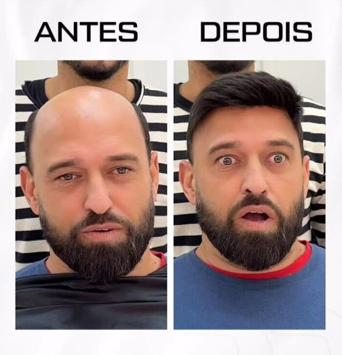 These 40 Men Got Non Surgical Hair Makeovers, And The Results Are Shockingly Natural Looking