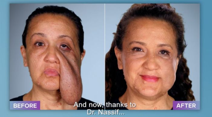 Plastic Surgeon Who Fixes &#8220;Botched&#8221; Operations Goes Viral After Netizens Discover Before-And-After Photos