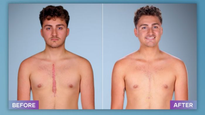 Plastic Surgeon Who Fixes &#8220;Botched&#8221; Operations Goes Viral After Netizens Discover Before-And-After Photos