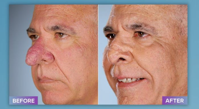 Plastic Surgeon Who Fixes &#8220;Botched&#8221; Operations Goes Viral After Netizens Discover Before-And-After Photos