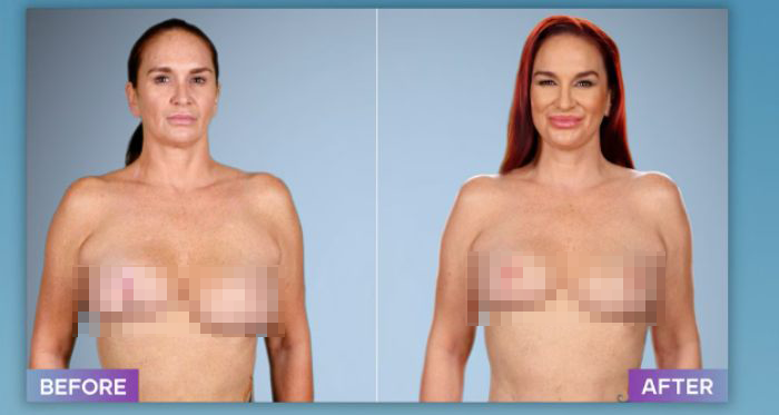 Plastic Surgeon Who Fixes &#8220;Botched&#8221; Operations Goes Viral After Netizens Discover Before-And-After Photos
