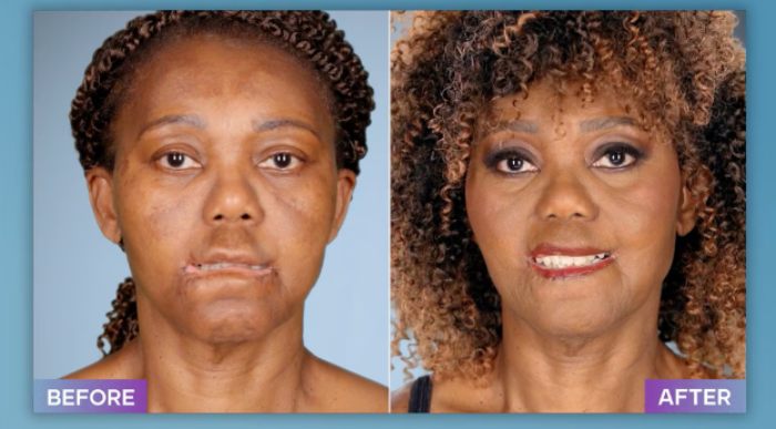 Plastic Surgeon Who Fixes &#8220;Botched&#8221; Operations Goes Viral After Netizens Discover Before-And-After Photos